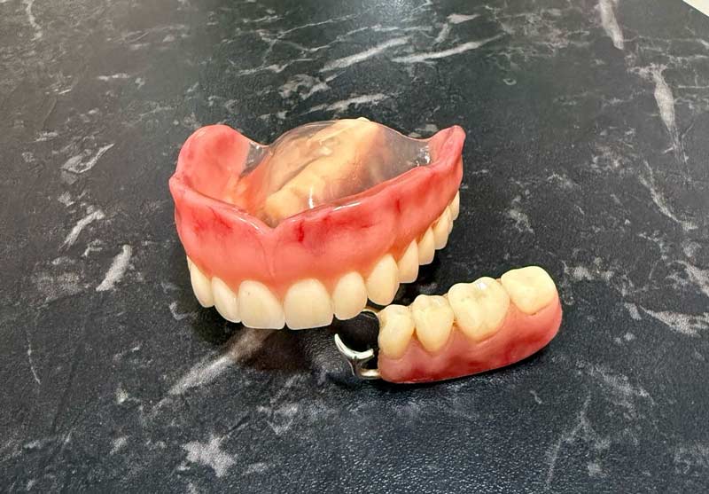 Proteses e Implantes